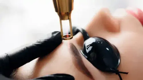 What Is the Average Cost of Laser Treatment for the Face in India?